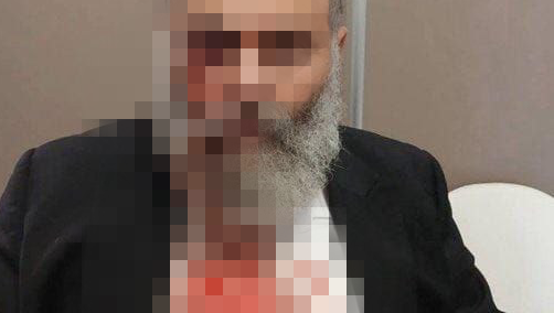 החרדי לאחר שהותקף