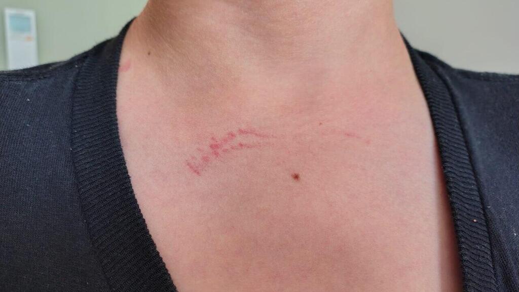 אנדי הילד המותקף