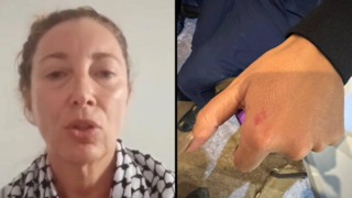 הנשיכה, רייס ריגו סרווייה