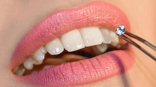 תכשיטי שיניים