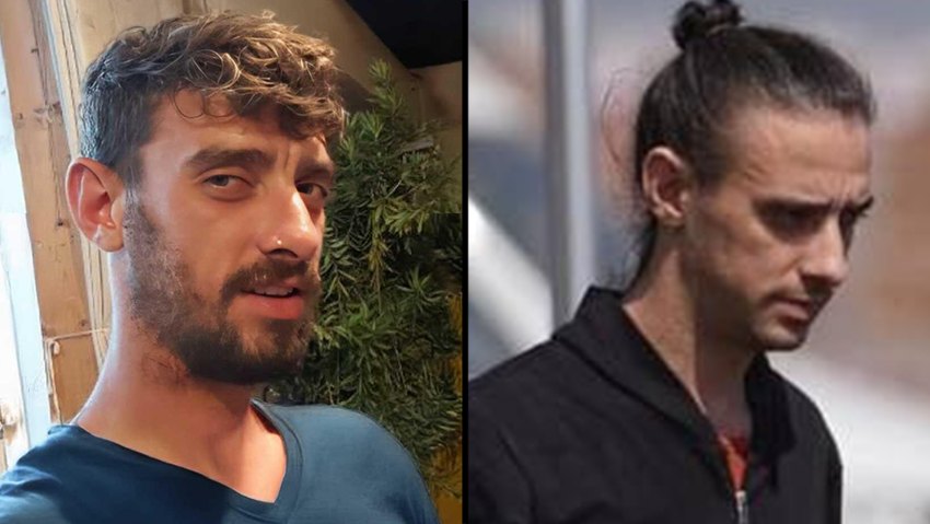  אריאל קוניו לפני ואחרי