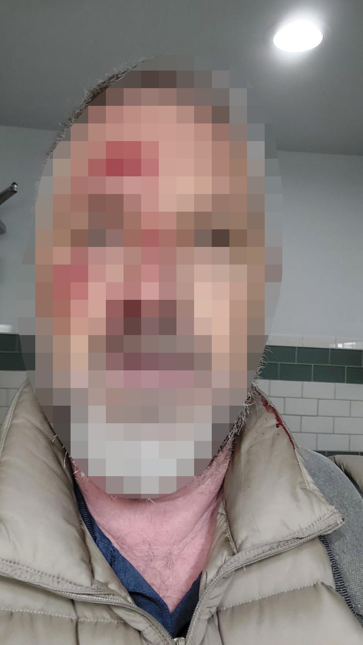 רמי גליקשטיין, הותקף על רקע אנטישמי במנהטן