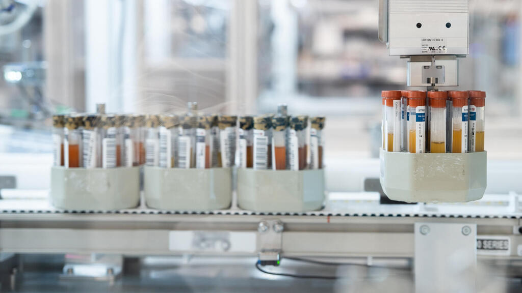 בדיקת גרייל לאבחון מוקדם - סרטן שד