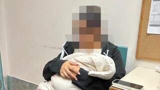 בנה של א' סבל מדימום חמור בעקבות ברית מילה