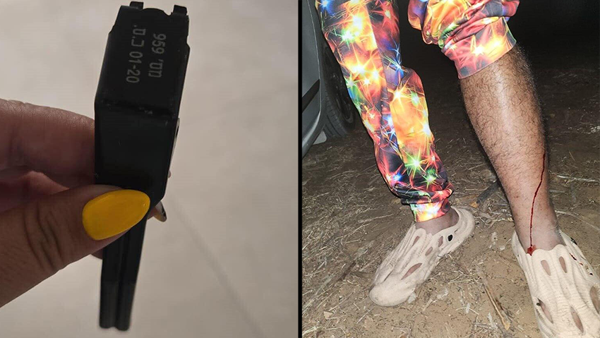 Фрагмент корпуса гранаты. Потсрадавший ( Публикуется в соответствии с п. 27 алеф Закона об авторских правах) בחור שנפצע מרסיס רימון במסיבה בצפון