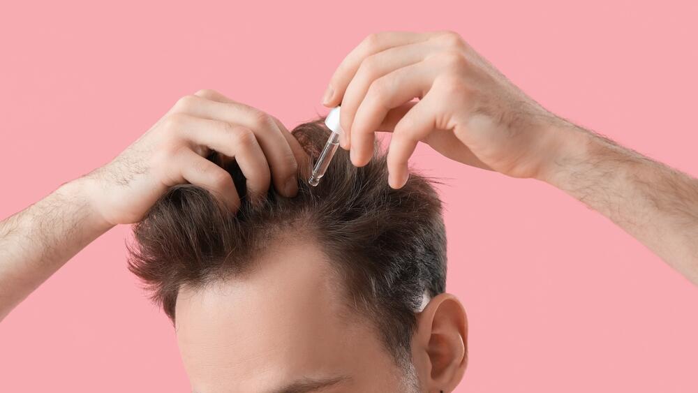 Photo: Shutterstock נשירת שיער