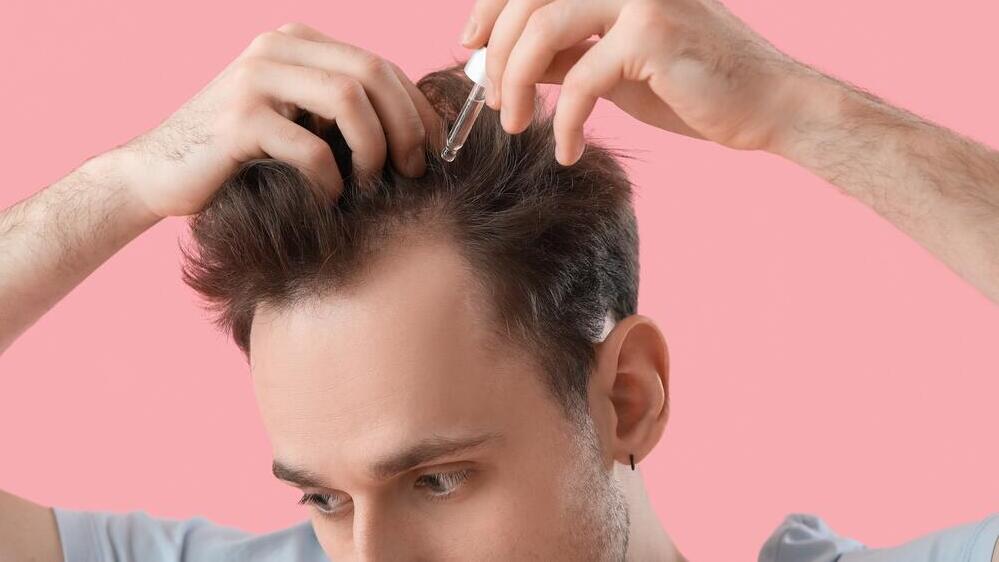 Фото: Shutterstock נשירת שיער