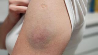 הפגיעה ביוליה חרתי באסותא