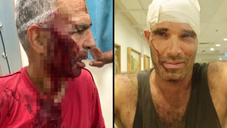 עודד ידעיה מחזיק את האבנים שנזרקו עליו, יובל בן ארי