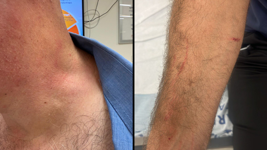 В Модиине избили водителя автобуса (Фото: "Коах ле-овдим") נהג אוטובוס שהותקף בשדרות ומודיעין עילית