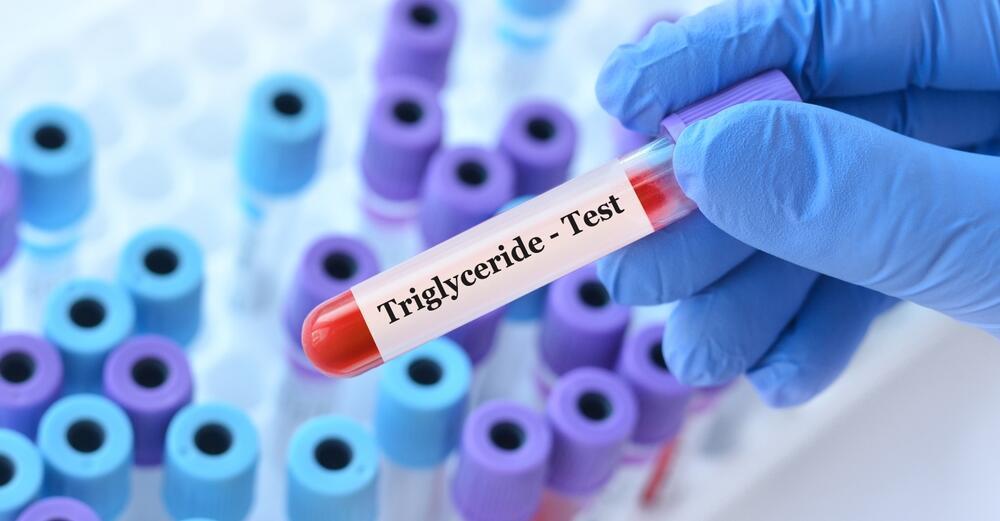 Triglyceride (Photo: Shutterstock) טריגליצרידים, שומנים בדם