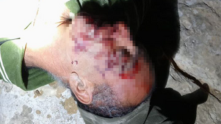 הותקפו על ידי מתנחלים במסאפר יטא