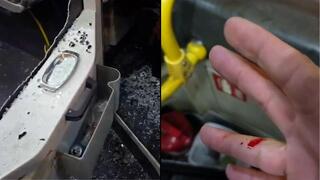 הנזק לאוטובוס והפציעה של הנהג