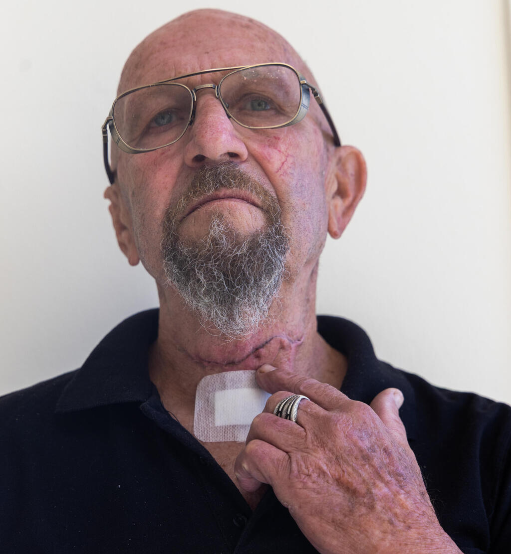 Шуки Лазарович (Фото: Авигайль Узи) חייו של שוקי לזרוביץ ניצלו לאחר שקנה הנשימה כמעט נקטע בתאונת עבודה