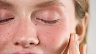 אשה שעברה הזרקת זרע סלמון בפנים