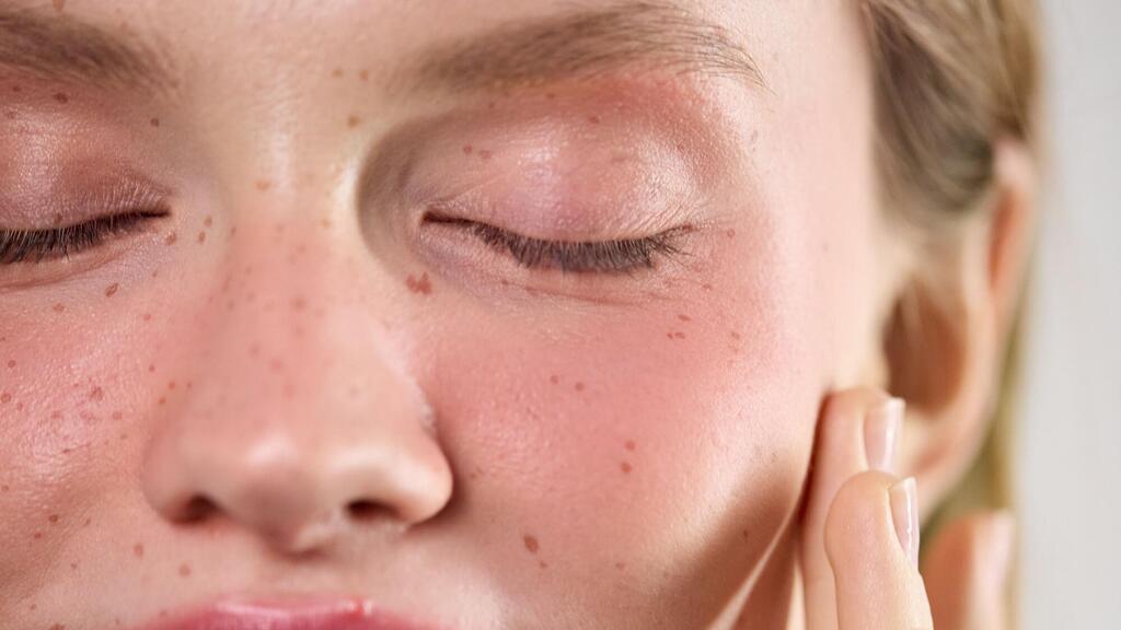 אשה שעברה הזרקת זרע סלמון בפנים