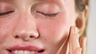 אשה שעברה הזרקת זרע סלמון בפנים