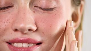 אשה שעברה הזרקת זרע סלמון בפנים