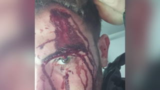 ישראלי הותקף באכזריות על ידי חבורת נפאלים בקטמנדו