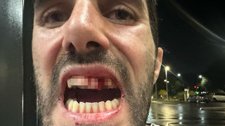 מטייל ישראלי בניו זילנד הותקף ע"י בחור מקומי