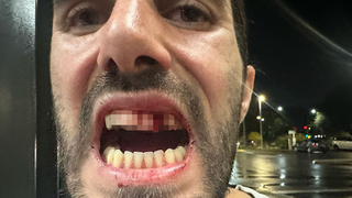 מטייל ישראלי בניו זילנד הותקף ע"י בחור מקומי