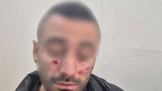 תושב ירושלים שהותקף בידי בלש משטרה אותו צילם