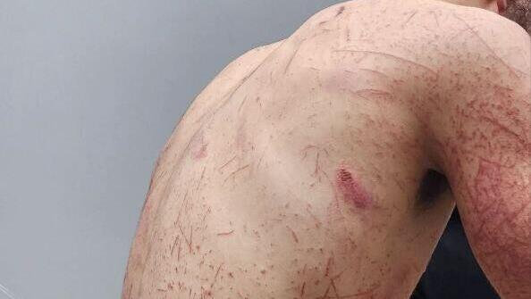 אוויס הומאם דיב, הצעיר הפלסטיני שהותקף בידי מתנחלים