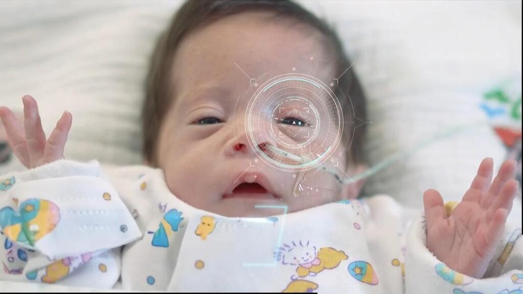 ניטור לא פולשני צהבת ילדים, מרכז שניידר