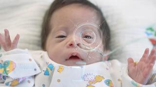 ניטור לא פולשני צהבת ילדים, מרכז שניידר