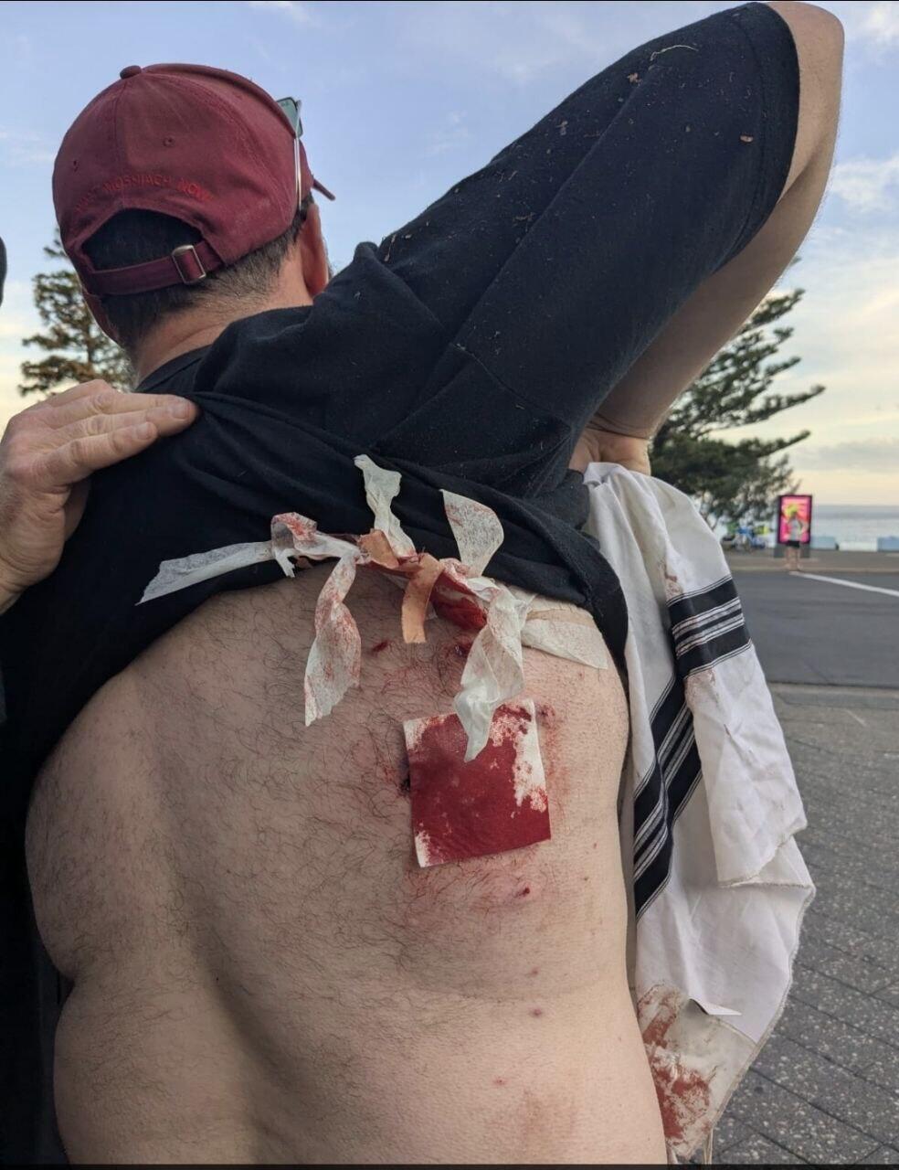 תיעוד: ירי המוני במסיבת חנוכה בסידני שבאוסטרליה