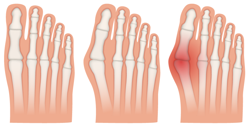 אינפו הלוקס ולגוס