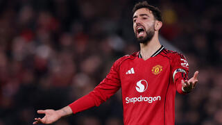 ברונו פרננדש מתוסכל