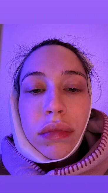 פיט דייוידסון אלסי יואיט