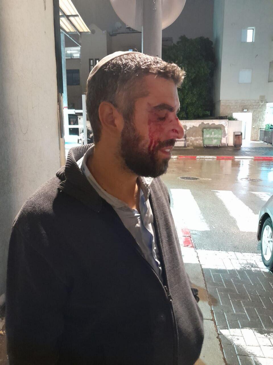 הרב לאחר התקיפה