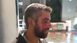 הרב לאחר התקיפה