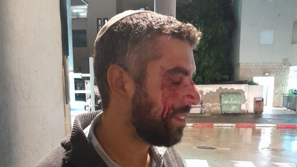 הרב לאחר התקיפה