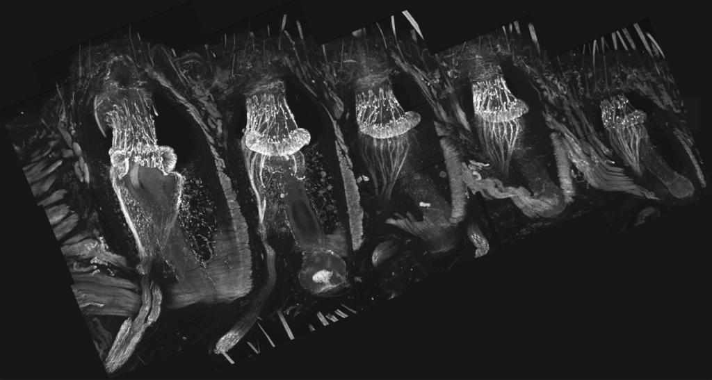 Five whisker follicles in a 100-micron-thick tissue section, viewed under a microscope. Each follicle is enveloped by a thick collagenous capsule surrounded by skeletal muscles. The follicle contains a bundle of mechanoreceptors, whose club-like endings are anchored within a suspended collagen-rich matrix at the level of the upper third of the follicle 