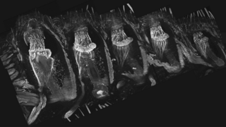 Five whisker follicles in a 100-micron-thick tissue section, viewed under a microscope. Each follicle is enveloped by a thick collagenous capsule surrounded by skeletal muscles. The follicle contains a bundle of mechanoreceptors, whose club-like endings are anchored within a suspended collagen-rich matrix at the level of the upper third of the follicle 