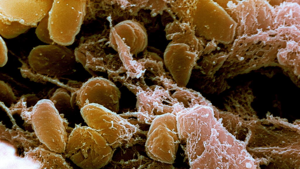 הפתוגן ירסינה פסטיס (Yersinia pestis)