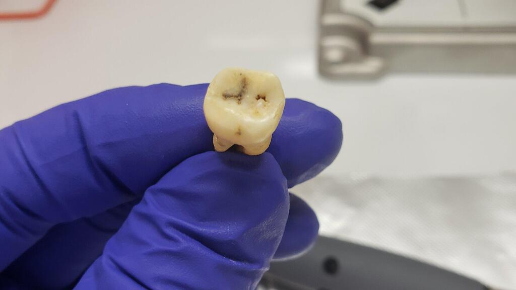 שן שהתגלתה באתר הארכאולוגי בג'רש