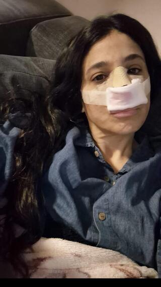 אהובית רבי-גולן רגע אחרי הניתוח