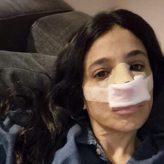 אהובית רבי-גולן רגע אחרי הניתוח