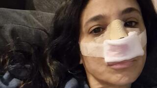 אהובית רבי-גולן רגע אחרי הניתוח