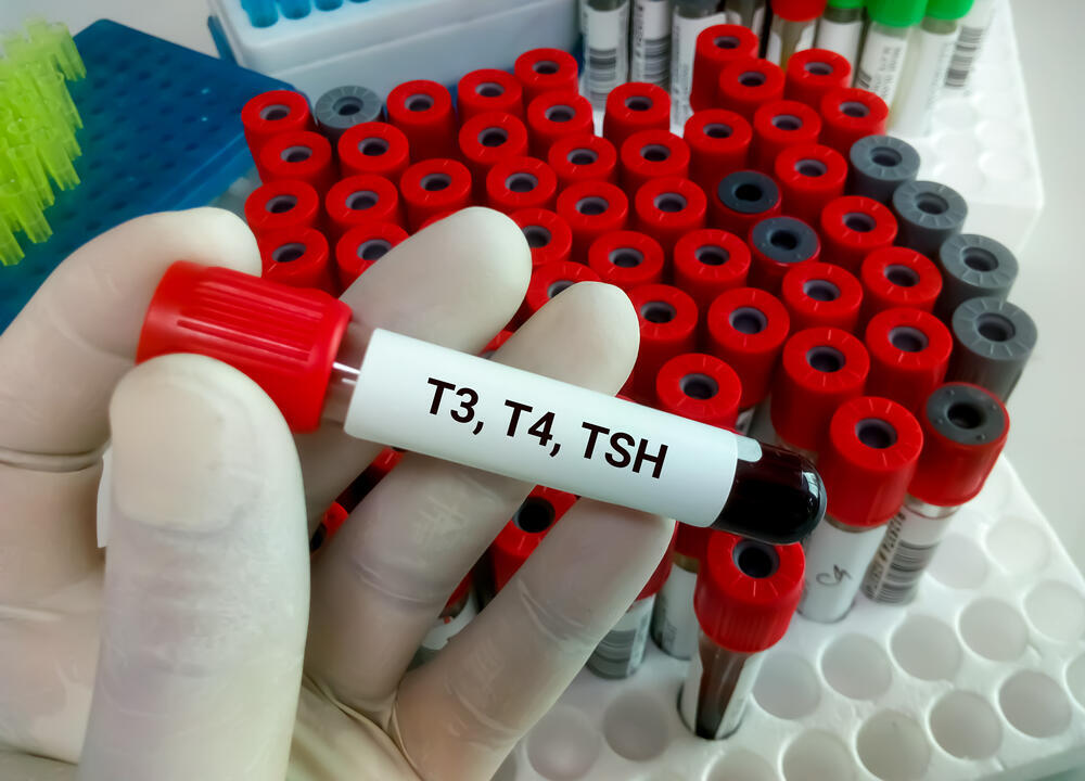 Simple blood tests can provide an initial picture of thyroid function (Photo: Shutterstock) בדיקת דם TSH