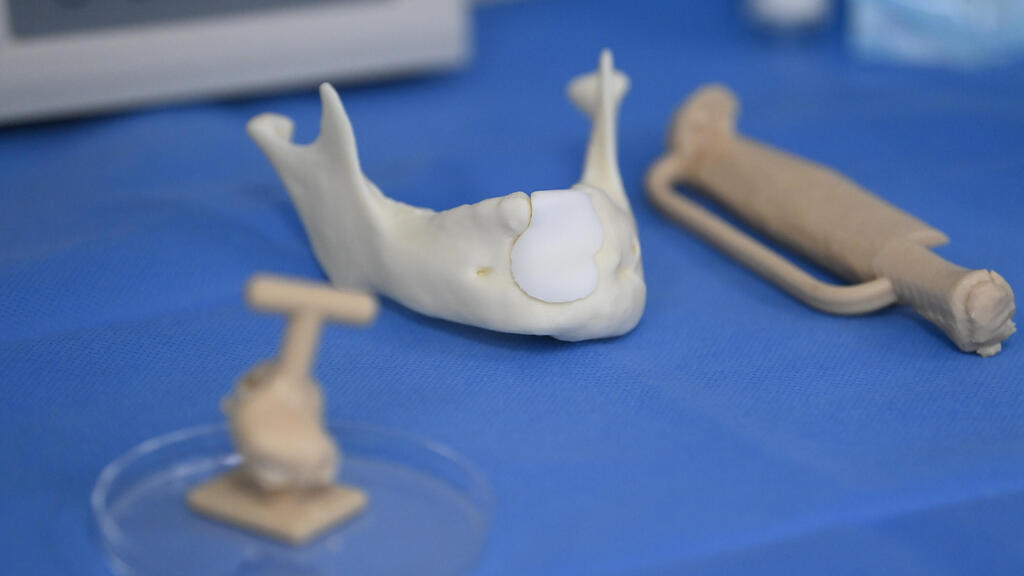 בנק הרקמות, שיבא