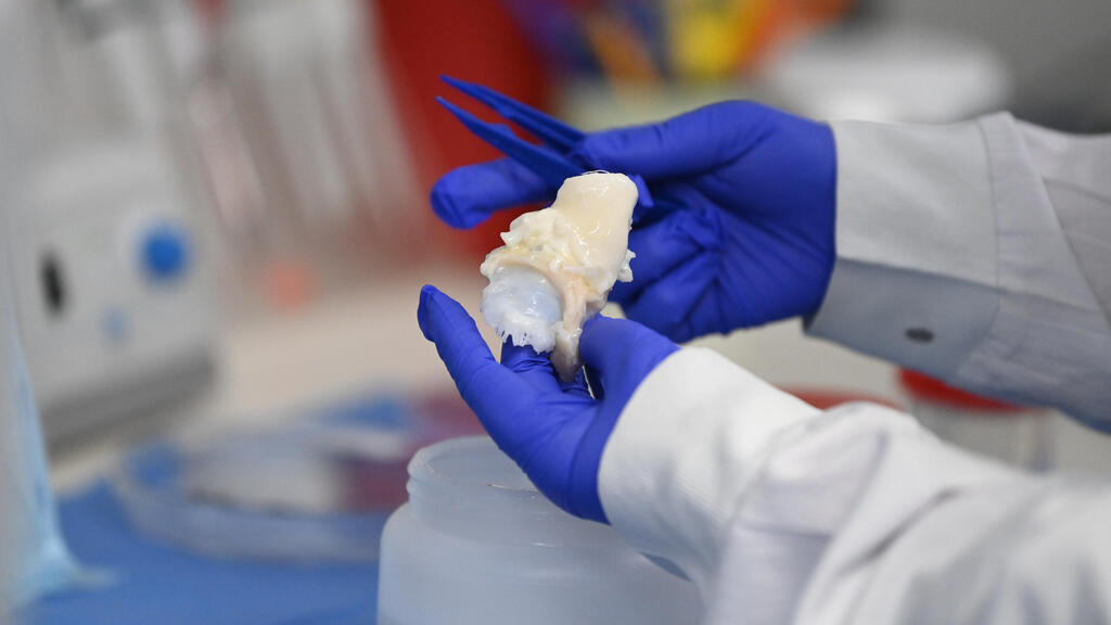 בנק הרקמות, שיבא