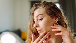 בעיות עור אקנה פיגמטציה נקבוביות פעורות