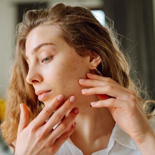 בעיות עור אקנה פיגמטציה נקבוביות פעורות