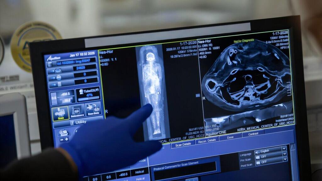 ניתוח סריקת ה-CT שבוצעה למומיה של כוהן הדת המצרי נס-חור