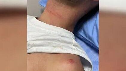 הישראלים שהותקפו